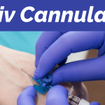 How to put a cannula: the easiest way in 2026?