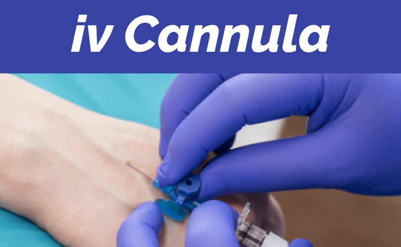 'IV cannula insertion procedure