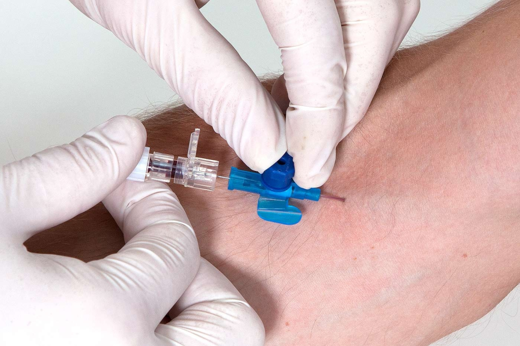 IV cannula insertin procedure
