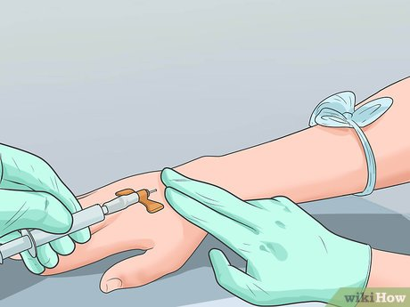 IV cannula insertion technique