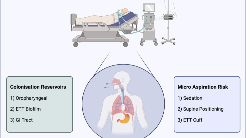 ventilator associated pneumonia