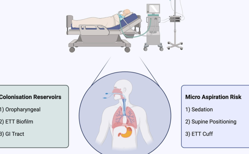 ventilator associated pneumonia VAP