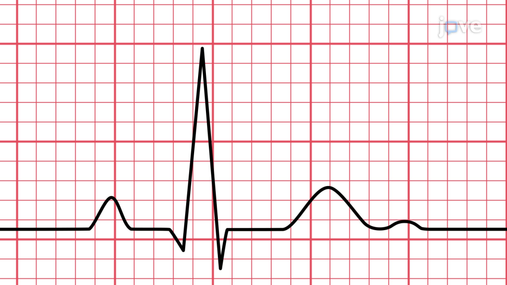 how to read an ECG in 2026