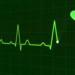 Ekg Considered a Diagnostic Test