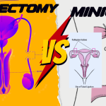Vasectomy vs Minilap vs laparotomy Loksewa Entrance MBBS/MD/MS and PSC Nepal Preparation Tips Tricks