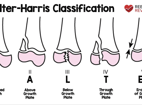 salter harris classification