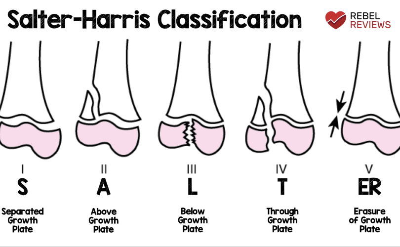 salter harris classification