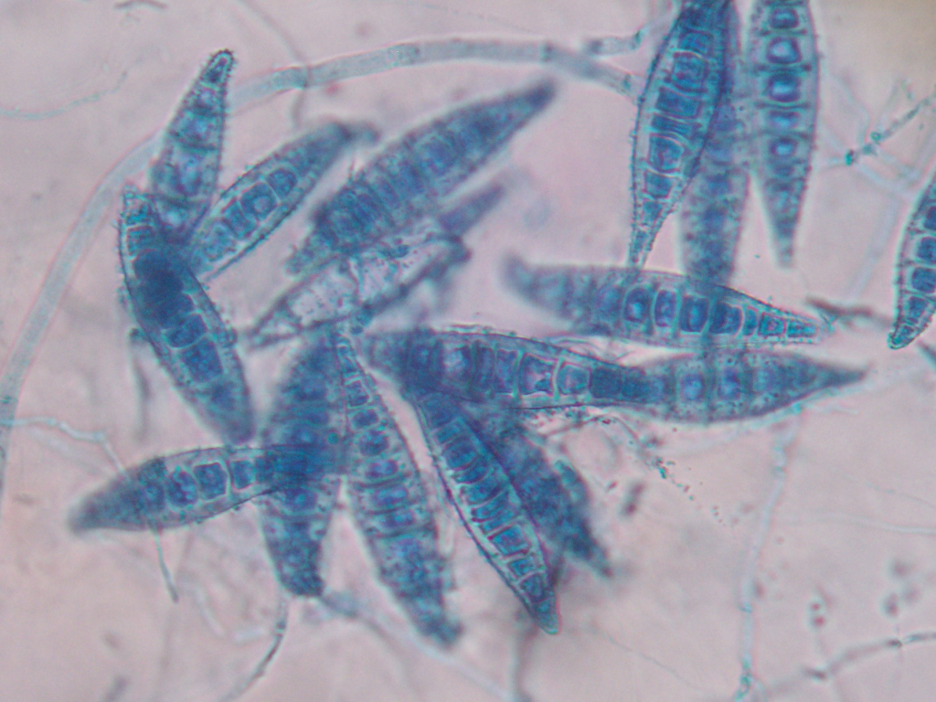 Microsporum canis (M canis) under microscope
