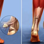 What are respiratory fluoroquinolones and what are their uses?