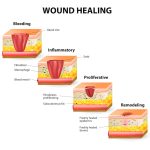 Wounds and gangrene, general principle of management of wounds, wounds classification
