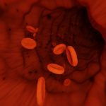 Atherosclerotic Cardiovascular Disease (ASCVD) Score Calculator and Interpretation