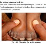 Dangers signs in newborns