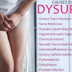 nonspecific urethritis Management