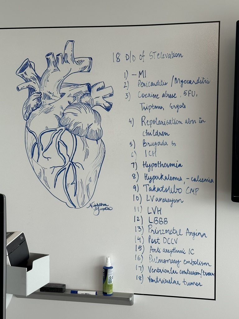 Is ST change always an MI? Top 18 Differentials of ST elevation you ...