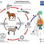 Casoni’s Test : Notes (Echinococcus)