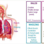 Comparison between wheeze and stridor