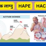 Lek lagnu explained (acute mountain sickness) लेक लाग्नु भनेको के हो?