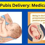 Face to Pubis delivery : What are the risk factors for it?