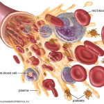 Causes of Anemia in Infants : The Shortcut and Mnemonics in Anemia Causes