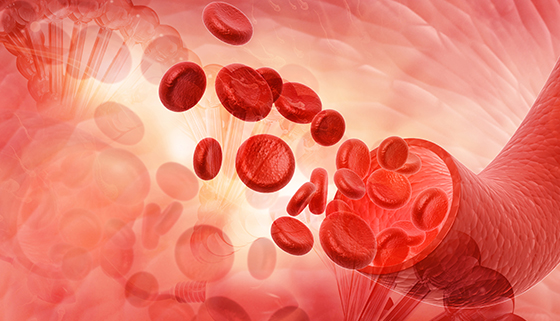 hremolytic anemia