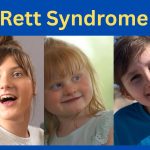 Rett Syndrome Notes for MD and DM level