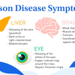 When is lactulose indicated in Wilson disease?