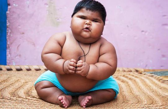 approach to baby with obesity