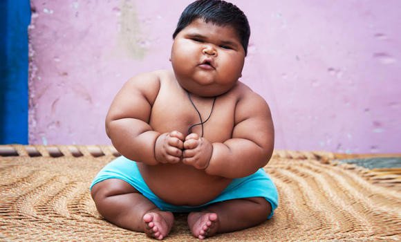 approach to baby with obesity