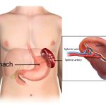 20 Common MCQs in The Spleen: Your Body’s Hidden Guardian
