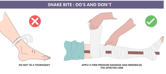 snakebite splinting method
