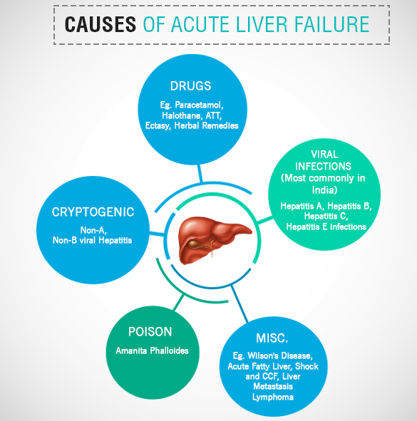 acute liver failure causes