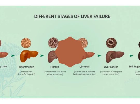 acute liver failure