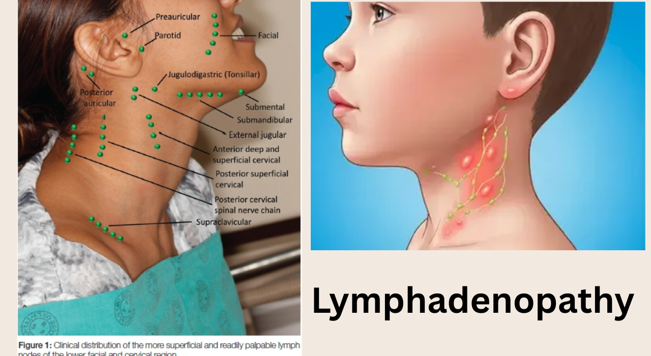 lymphadenopathy cause