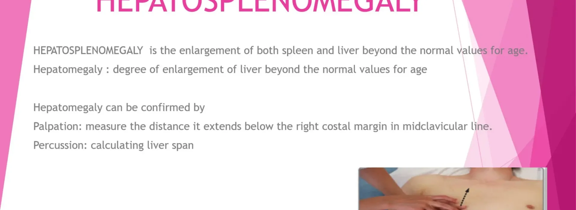 hepatosplenomegaly