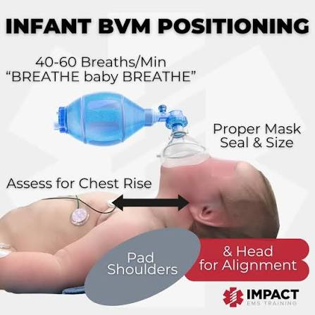 infant bag and mask ventilation position