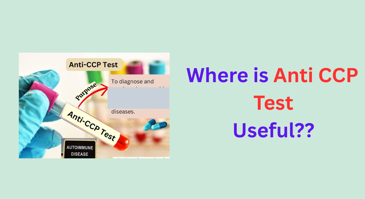 anticcp test usefulness for