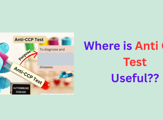anticcp test usefulness for