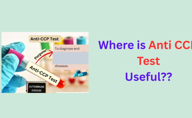 anticcp test usefulness for